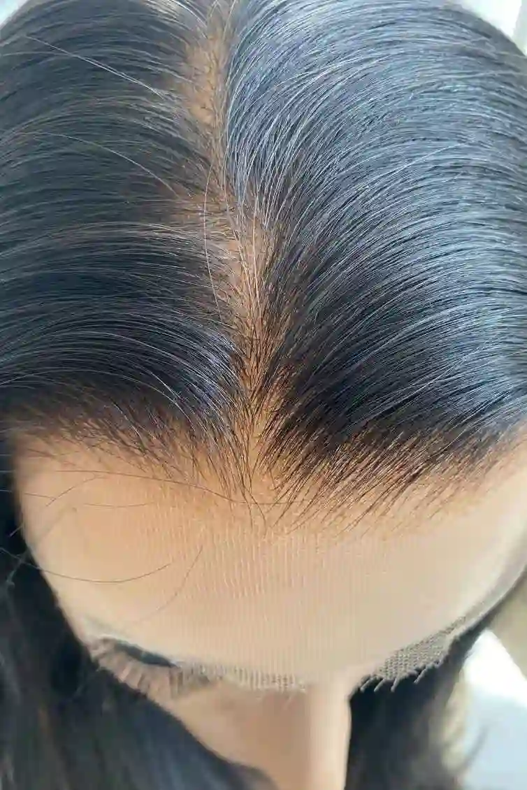 Natural Hair Line With Bleached Knots
